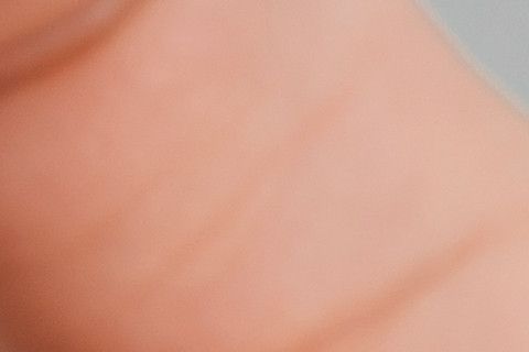 akupunktur-hakkinda-genis-bilgi