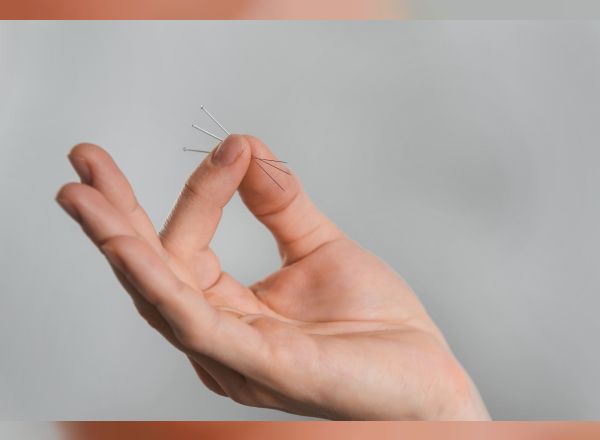 akupunktur-hakkinda-genis-bilgi