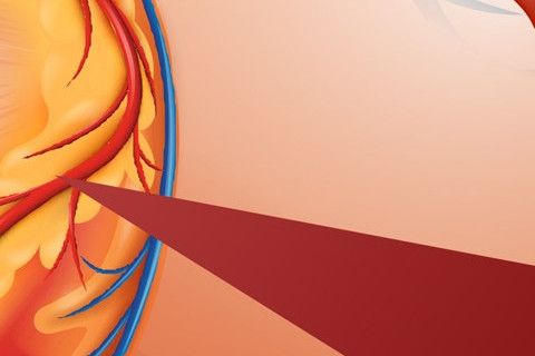 damar-sertligine-bitkisel-destek