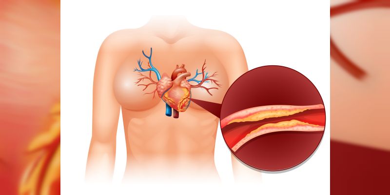 Damar Sertliğine Bitkisel Destek