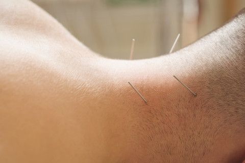 intramuskuler-stimulasyon-ims