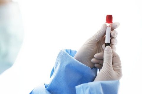 kandan-agir-metal-testi