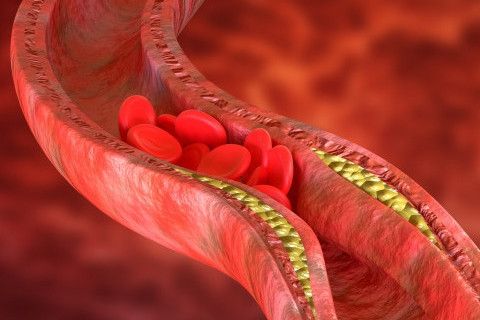 kolesterol-ve-beslenme