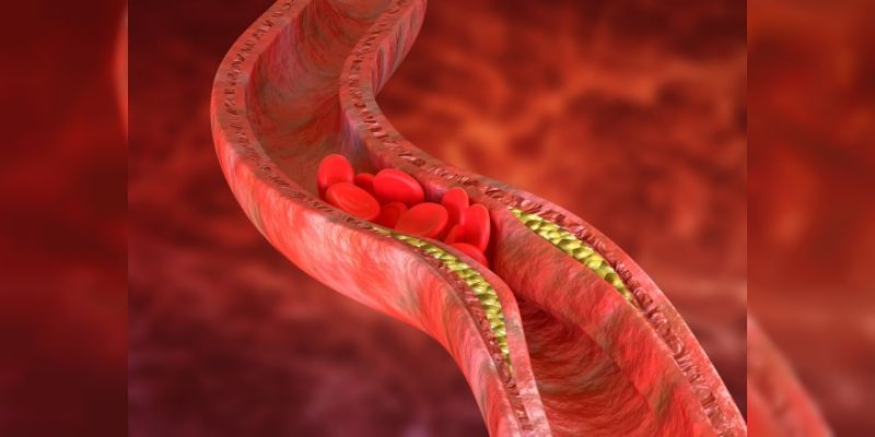 Kolesterol ve Beslenme