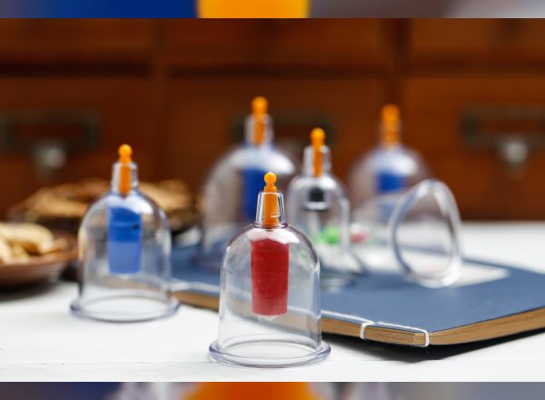 kupa-uygulamasinin-tarihcesi-ve-onemi