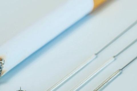 akupunkturla-sigara-birakma