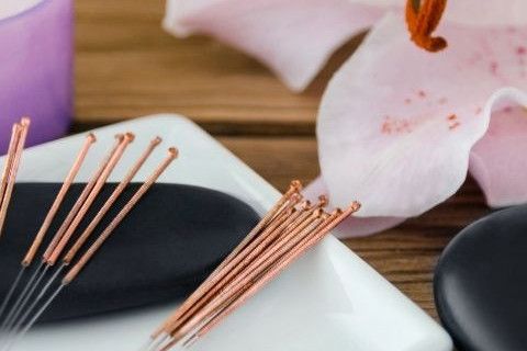 akupunkturla-zayiflama