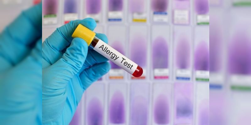 kandan-alerji-testi