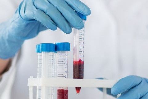 kandan-candida-testi