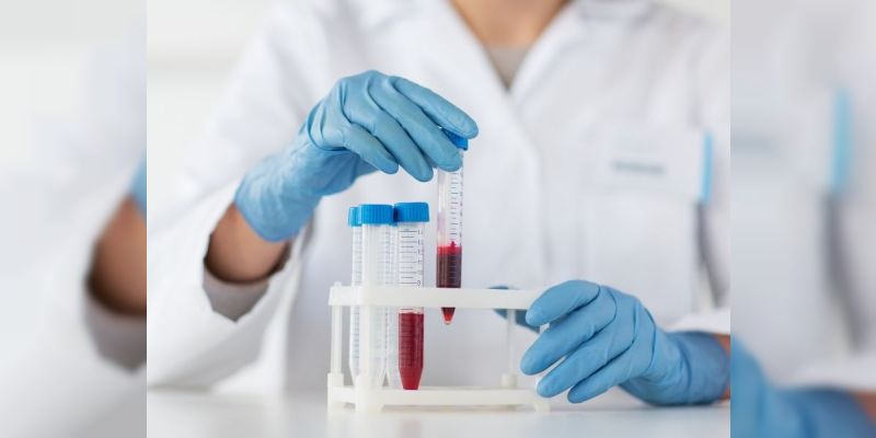 kandan-candida-testi