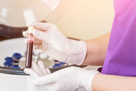 prp-nedir-uygulama-alanlari-nelerdir