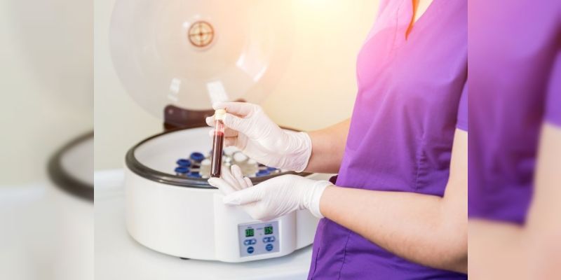 prp-nedir-uygulama-alanlari-nelerdir